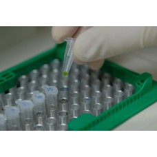 Metabolomics Sample Preparation